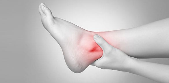 Chronic Ankle Instability Los Angeles Orthopedic Group 2 - Chronic Ankle Instability