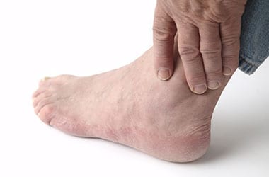 Chronic Ankle Instability Los Angeles Orthopedic Group Thumb - Conditions