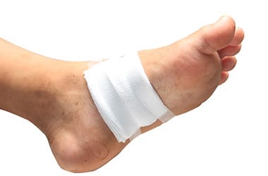 Diabetic Ulcers Los Angeles Orthopedic Group Thumb - Conditions