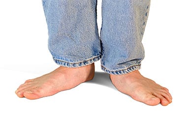 Flat Feet High Arches Los Angeles Orthopedic Group Thumb - Conditions