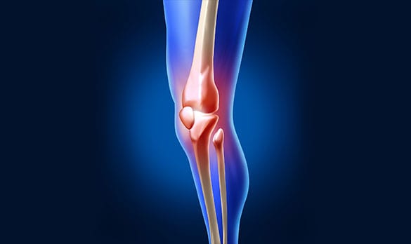 Joint Instability Los Angeles Orthopedic Group 1 - Joint Instability