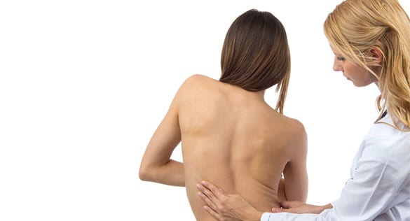 Scoliosis Los Angeles Orthopedic Group 1 - Scoliosis