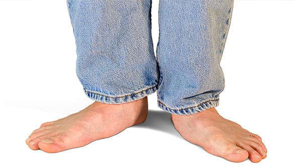 Surgical Flat Foot Correction Los Angeles Orthopedic Group 3 - Surgical Flat Foot Correction