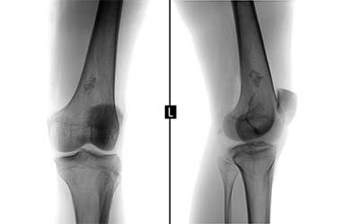 Knee Doctor in Los Angeles Los Angeles Orthopedic Group Thumb - Useful Links