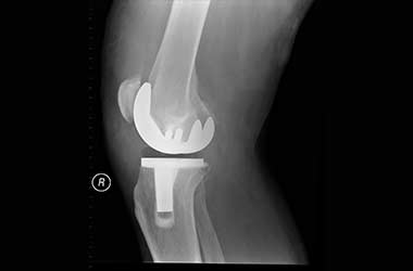 Knee Specialist in Los Angeles Los Angeles Orthopedic Group Thumb - Useful Links