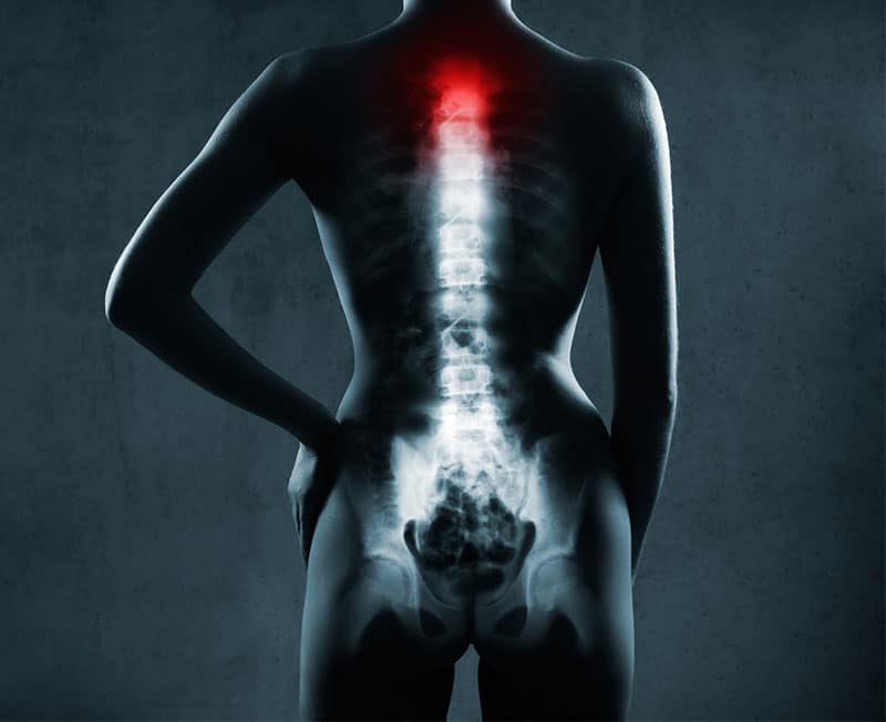 Outpatient Laser Spine Surgery Los Angeles Orthopedic Group - Home