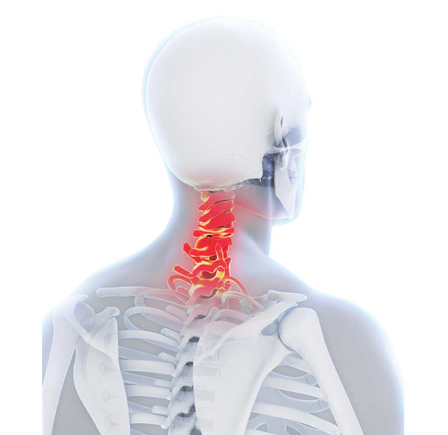 Outpatient Laser Spine Surgery Los Angeles Orthopedic Group1 - Laser Spine Surgery (Outpatient)