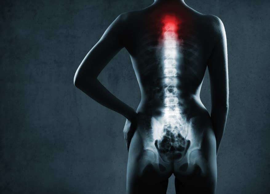Outpatient Laser Spine Surgery Los Angeles Orthopedic Group3 - Laser Spine Surgery (Outpatient)