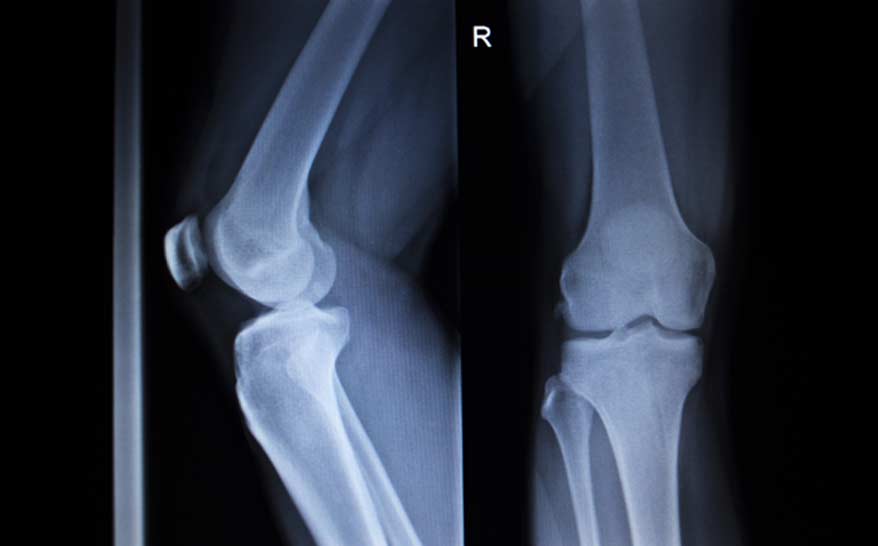 exam to evaluate knee surgery Los Angeles Orthopedic Group - Knee Surgery